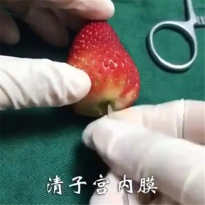 人流的危害科普,人流是不是越年轻伤害越大