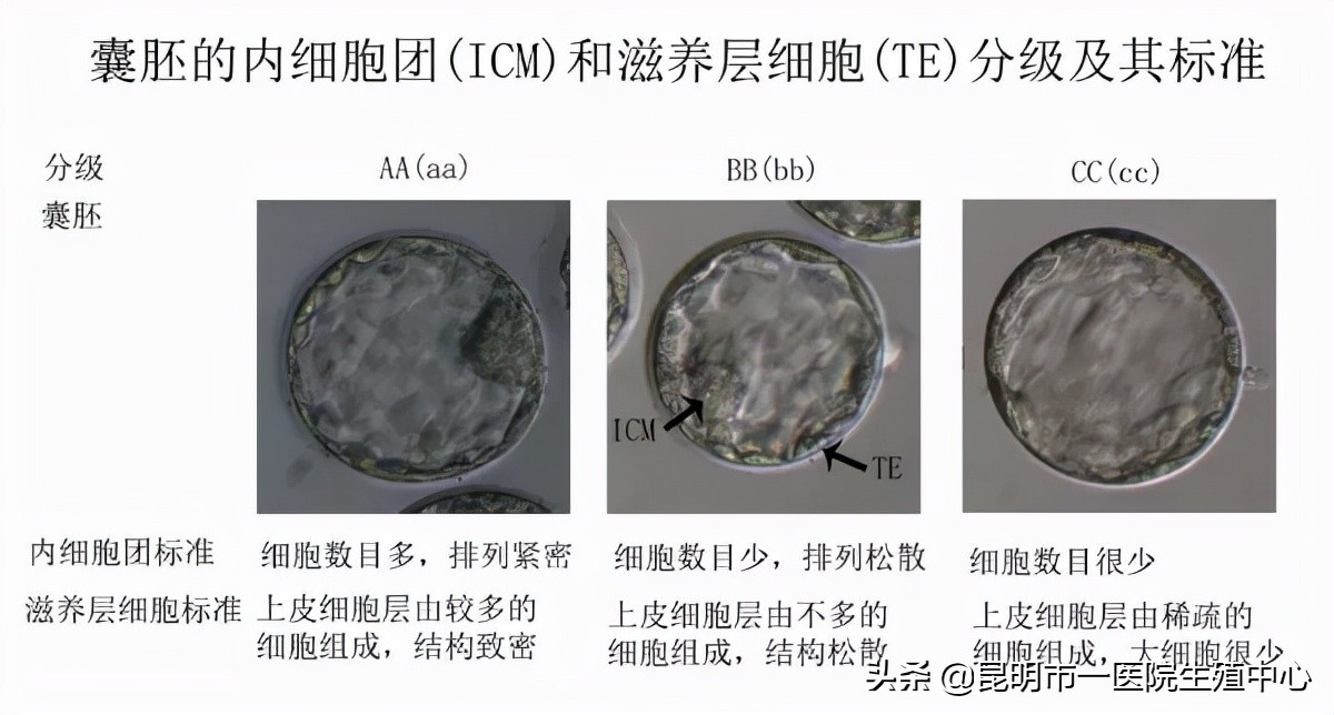 试管小白——“顶流”级别的胚胎长啥样？