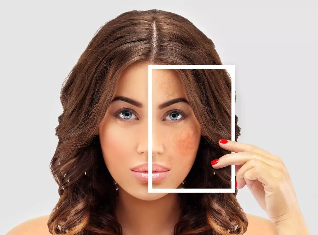 宣博士修复面膜,宣博士专业淡斑怎么样