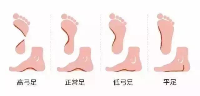 鞋款如何判断合适不合脚,鞋子合不合适只有脚知道说说