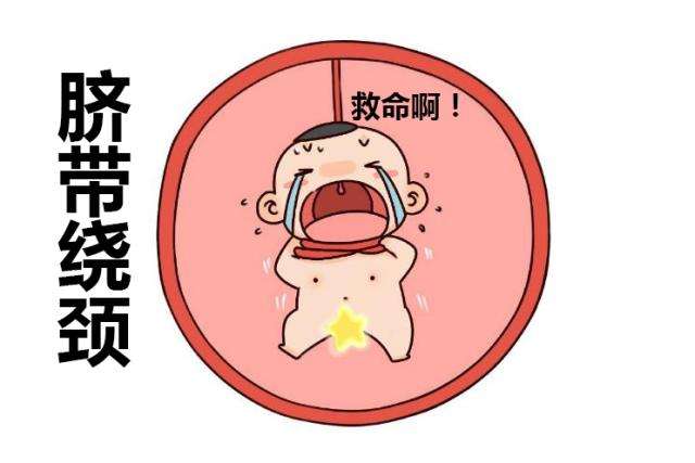 孕检胎儿绕颈一周怎么办,孕检胎儿绕颈会自动恢复吗