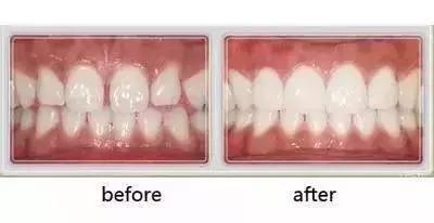 helen鐗欓娇,helen鐗欑涓績鍥剧墖