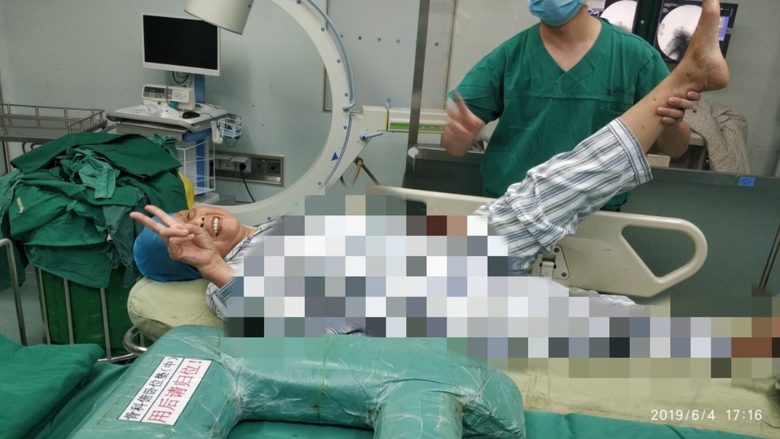 腰痛扎小针刀行吗,腰痛针灸需要吃药嘛