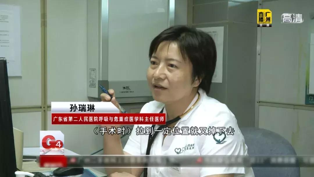 女子咳嗽20年竟因鸡骨头卡气管,大人痰卡住气管急救方法