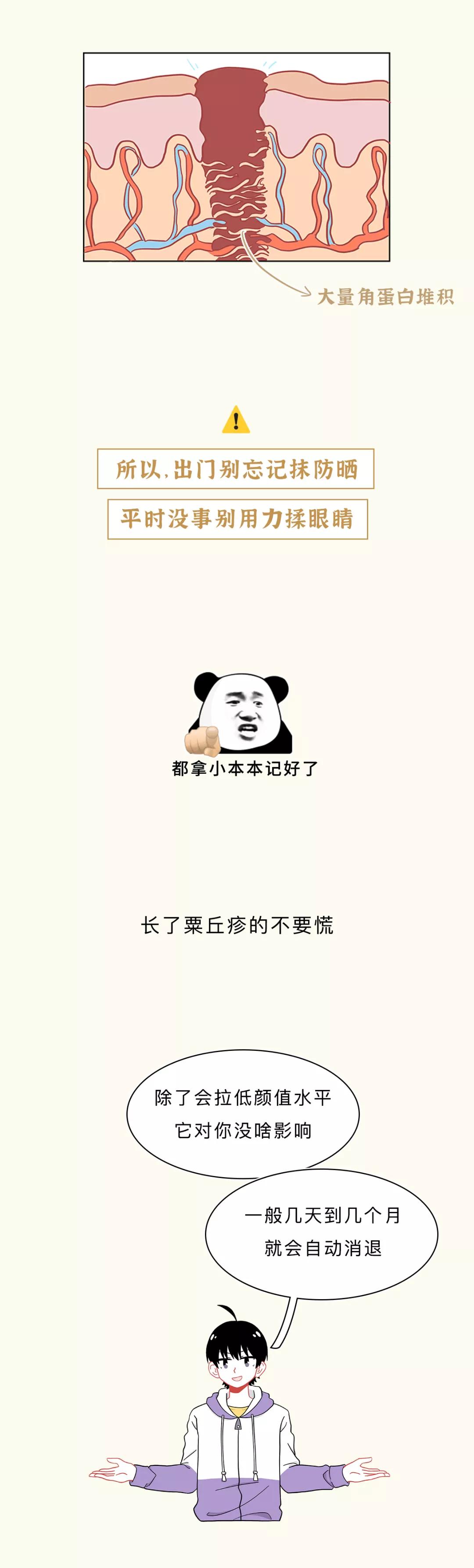 眼睛周围的脂肪粒会传染吗,去眼睛周围脂肪粒最佳方法