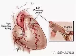 输液过敏,已经配了的药该退钱吗?