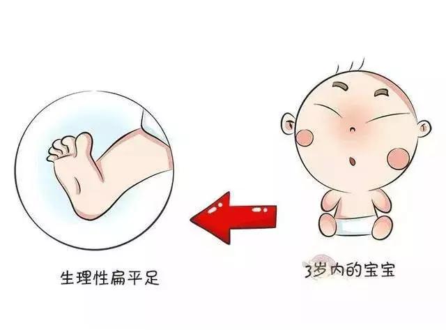 足部ct可以看出是不是扁平足吗,孩子脚部知识