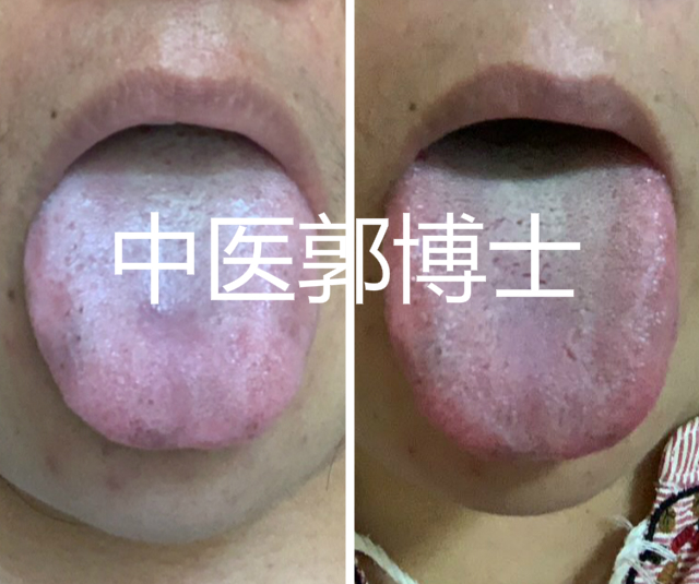 生完孩子一身病,生完孩子多久喝中药调理