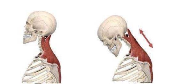 颈椎曲度变直正常生理曲度消失,颈椎曲度变直如何有效恢复