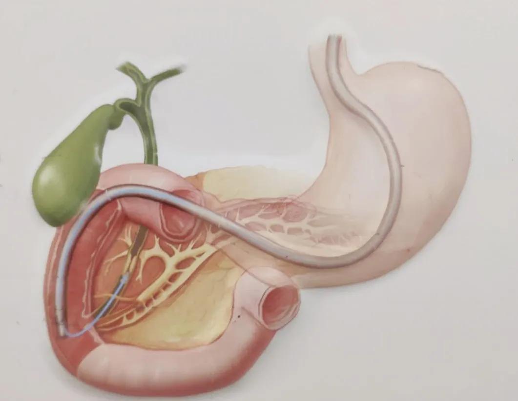 消化内科专家夏兴洲视频,夏兴洲消化内科专家