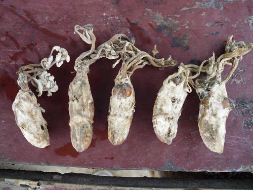 软坚散结专治癌症结节,病理检查发现结节是癌症吗