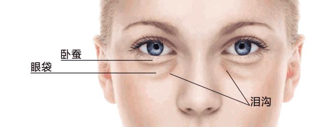 苏大强p眼袋,苏大强眼袋对颜值的影响
