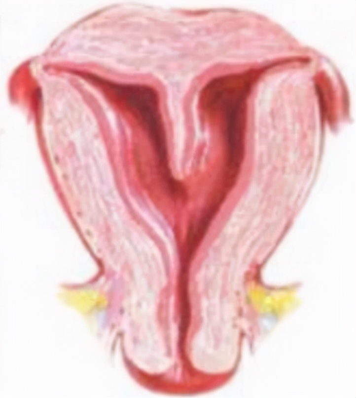 专家介绍子宫畸形种类,子宫疾病的介绍