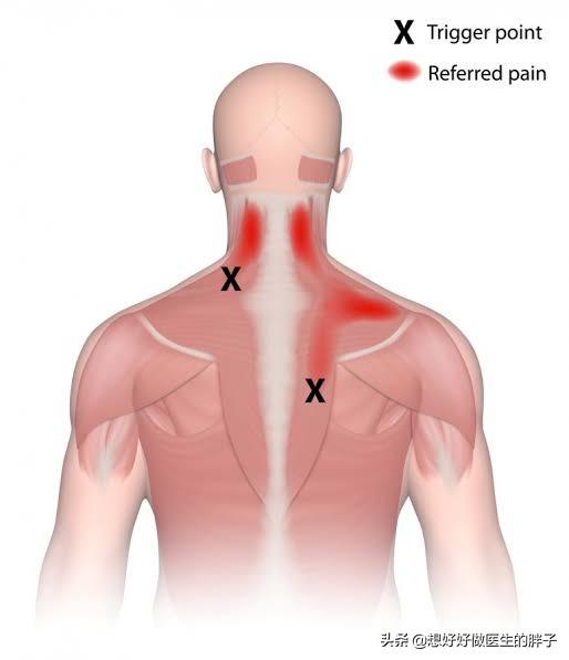 引起颈肩疼痛的原因有哪些,引起颈肩痛和腰腿痛的主要原因