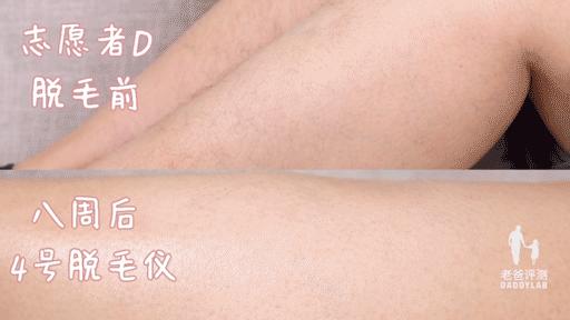 最真实的脱毛仪,bequeen脱毛仪实测