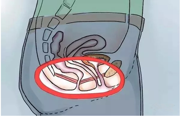 产后盆底肌修复案例,产后六七年盆底肌修复最简单动作