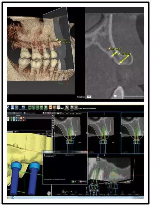 98%的人嘴里都有一颗“定时*弹炸**”，看看你中招了吗？