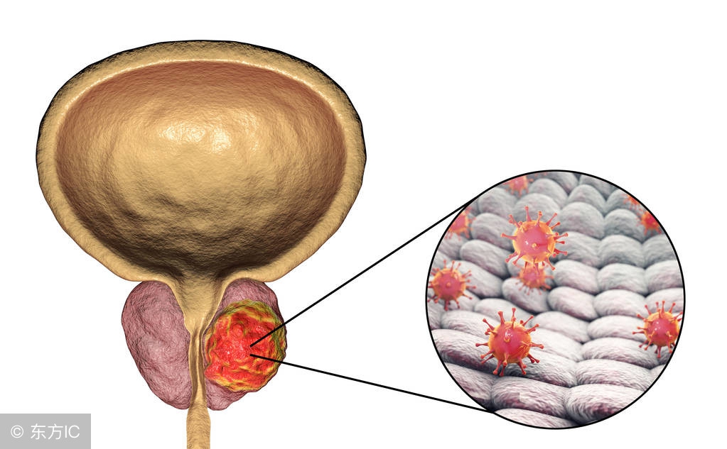 前列腺炎该不该吃消炎药,前列腺炎怎么才能彻底治愈好得快