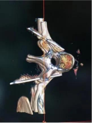 手汗症中医诊疗方案,手掌多汗症怎么治疗