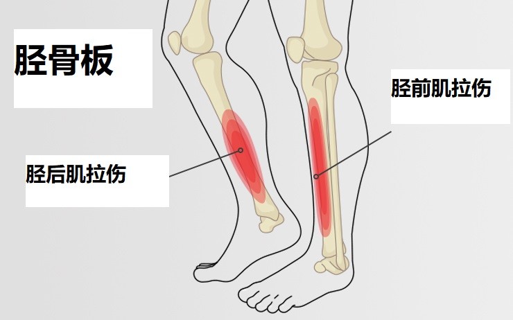 儿童小腿胫骨疼痛怎么回事,孩子胫骨疼不能走路怎么回事