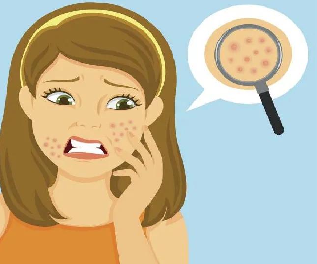 严重一点的痘坑,再见痘痘肌怎么修复