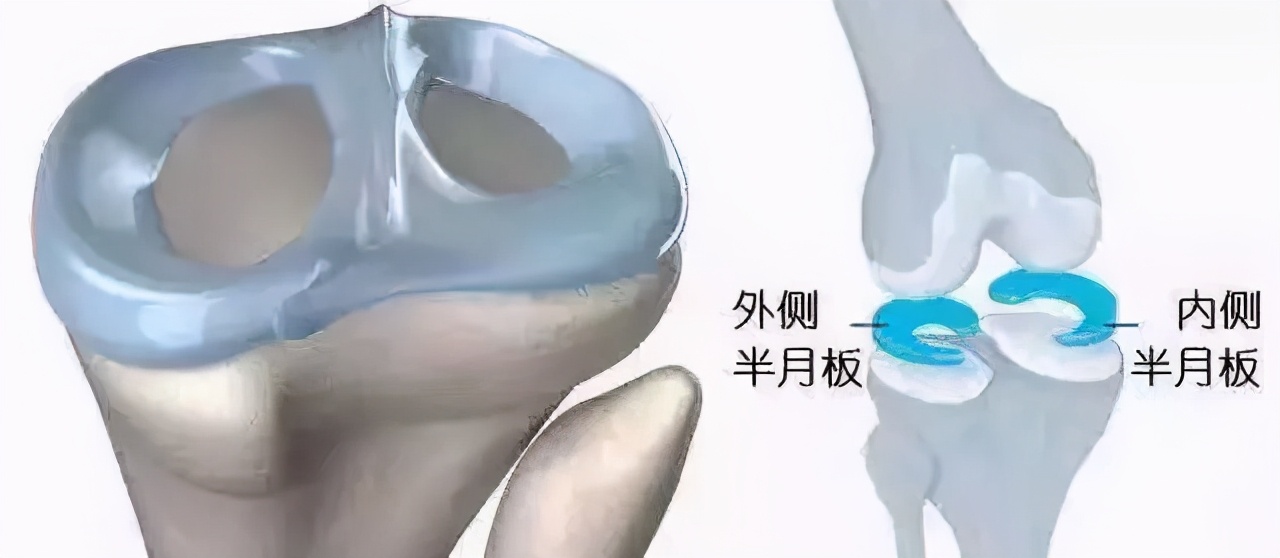 关于半月板的知识,半月板损伤科普小知识