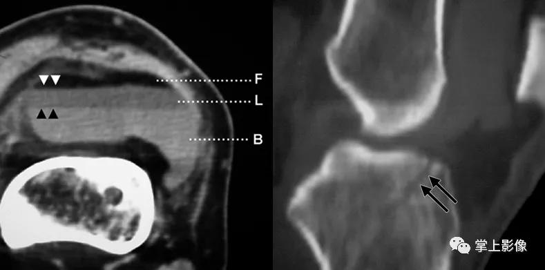 一种很少人知道的疾病,有哪些关节疾病