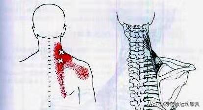 上背部受伤的康复训练,上背康复训练动作