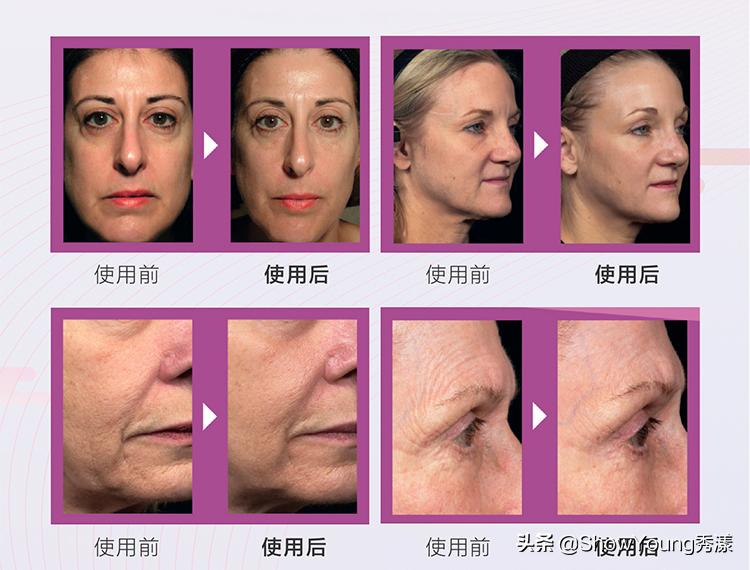 母亲节礼物走心实用带盒,母亲节特别的礼物推荐