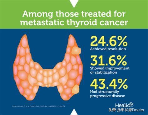 甲癌5项报告,甲癌最新研究