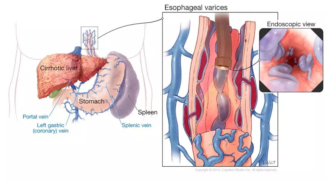 食管动脉血供来源,食管淋巴引流区