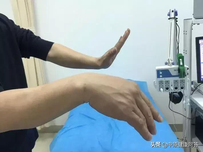 酒后手发麻僵硬,男子醉酒失去意识