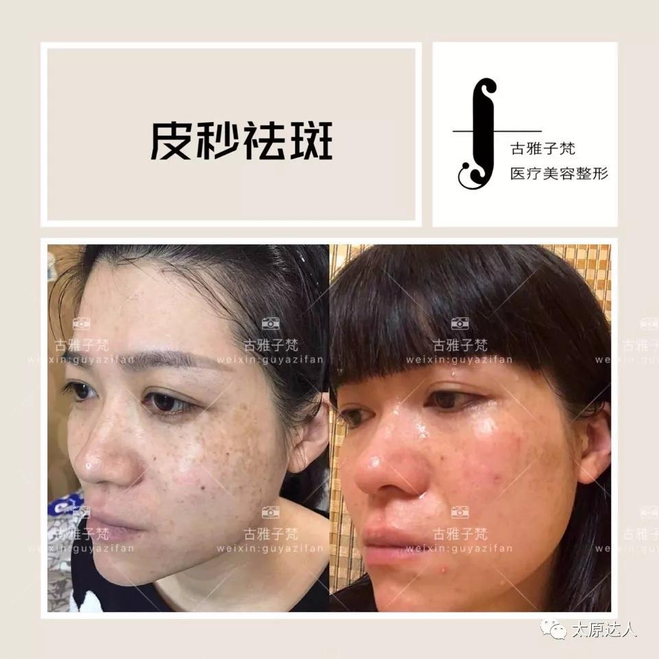 814元人气精华护理免费做！一次就焕颜新生！聚会女王就是你