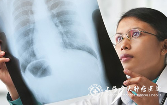 癌症患者容易疲劳怎么调理,癌症患者总是感觉疲劳是怎么回事