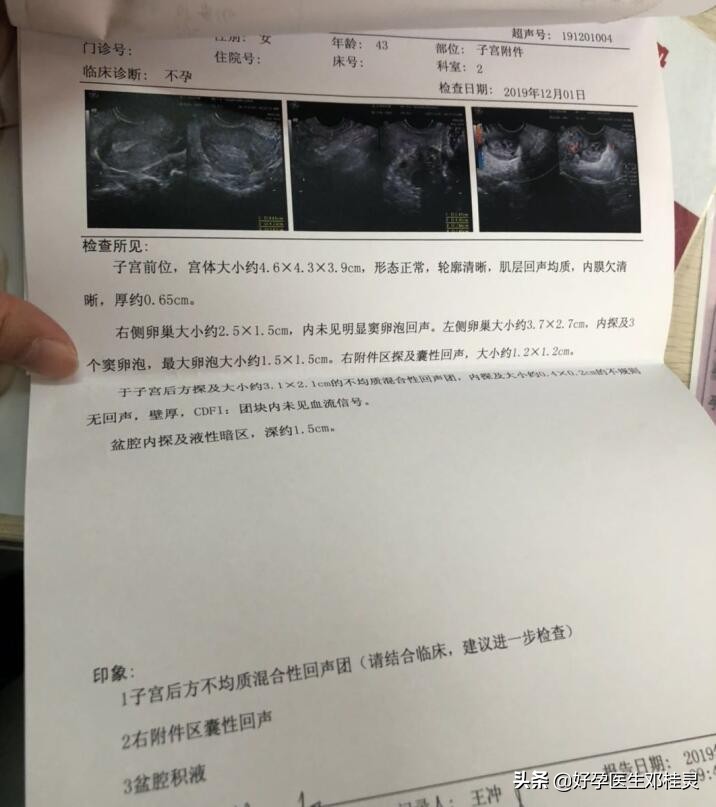 月经淋漓不尽一个多月偶有血块,月经淋漓不尽一个月小腹坠痛