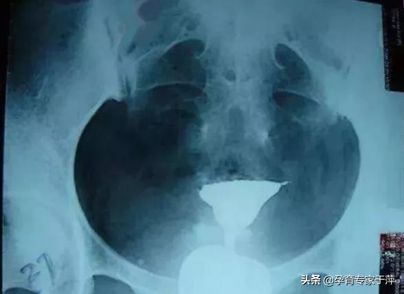 助孕专家于萍,青岛医生于萍视频