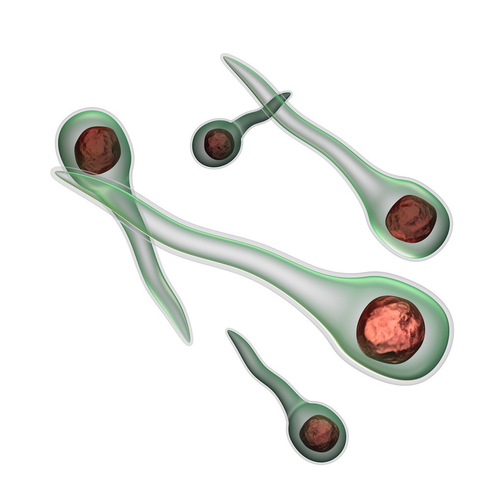 出很多血的伤口会感染破伤风吗,如果感染了破伤风伤口是什么情况