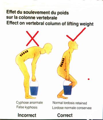腰椎滑脱和腰椎间盘突出哪个严重,想知道腰椎间盘突出是怎样引起的