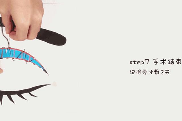 割双眼皮埋线和全切有什么区别,全切双眼皮内眼角割的不一样