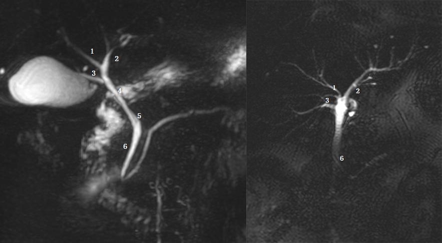 胆道系统解剖生理讲课视频,超声胆道系统的解剖生理