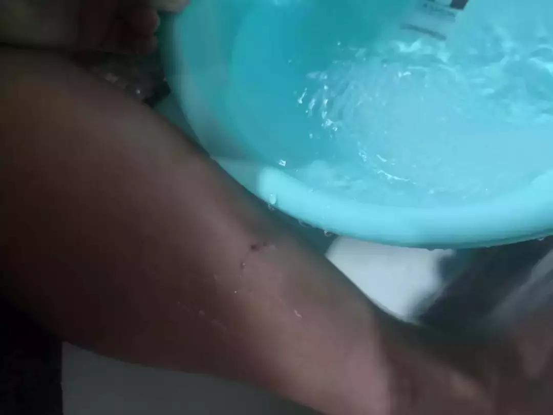 瑞安全城通缉一条白色肇事犬！已咬伤多人，目前已抓获2条疑似犬，将继续加强全城搜寻