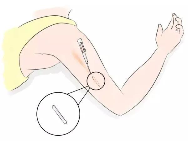 安全期危险期靠谱吗,安全期最准的方法