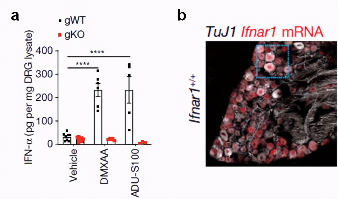 腰酸背痛吃点补品,腰酸背痛喝中药有效果吗