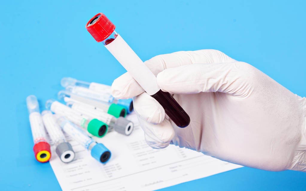 空腹血糖6.6糖化6.7算糖尿病吗,空腹血糖6.6餐后9.0是糖尿病吗