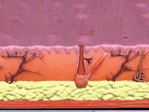 红痘印和红痘痘怎么祛,祛痘疤痘印痘坑最有效的方法