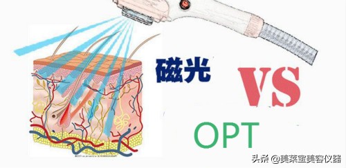 磁光360脱毛仪的功效,360磁光脱毛仪嫩肤操作