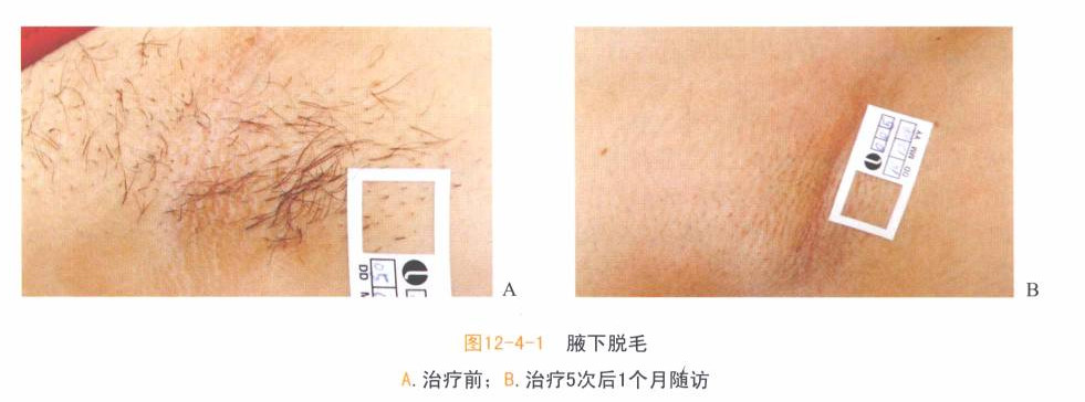 做了它，能让我的皮肤年轻十岁吗？