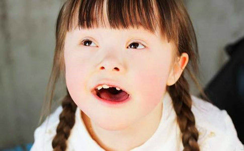 怎样避免怀上唐氏,怎样避免生出唐氏宝宝