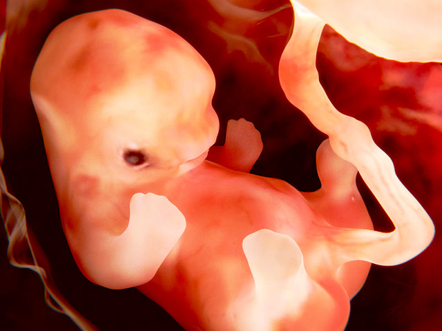 怀孕初期出血怎样判断已经流产,怀孕早期出血需要检查什么