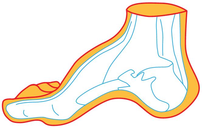 足弓塌的危害,足弓塌陷的危害有哪些